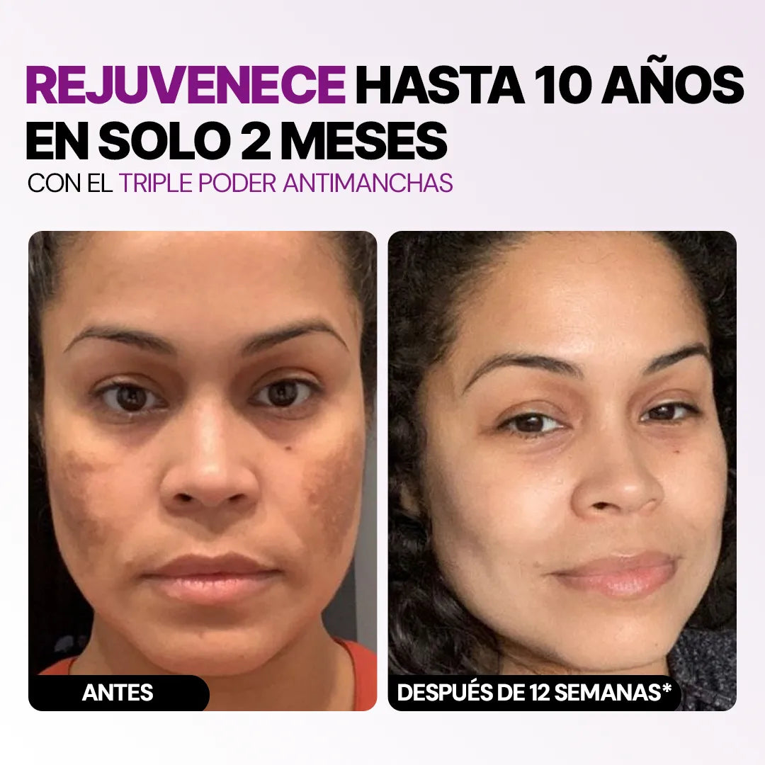 Combo Rejuvenece en 30 Días