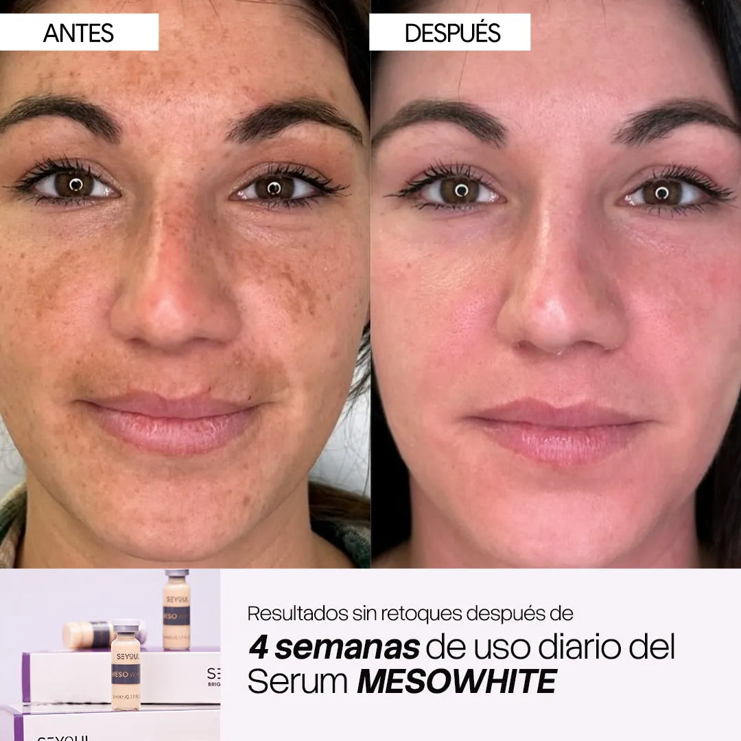 Células madre Mesowhite