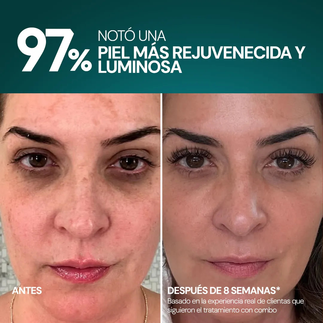 Combo Rejuvenecedor 3 en 1