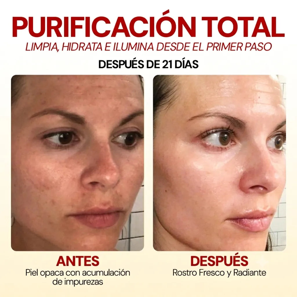Combo Purificación Total