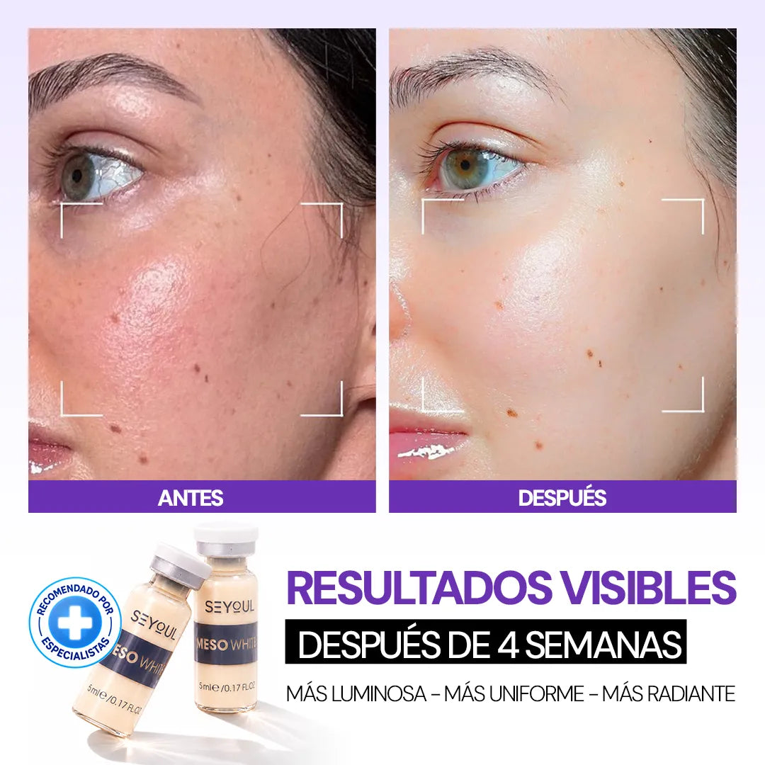 Células madre Mesowhite