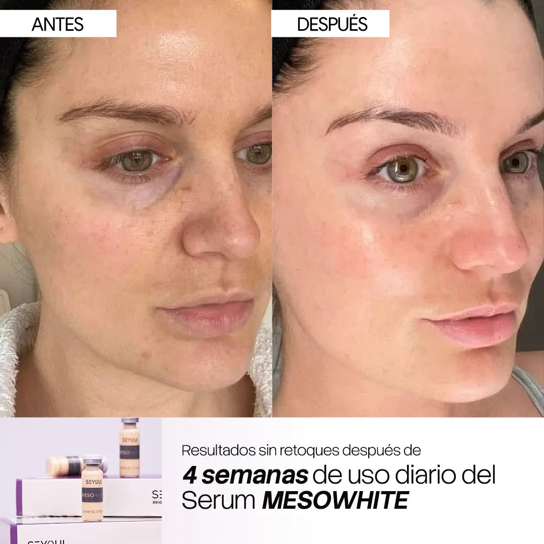 Células madre Mesowhite