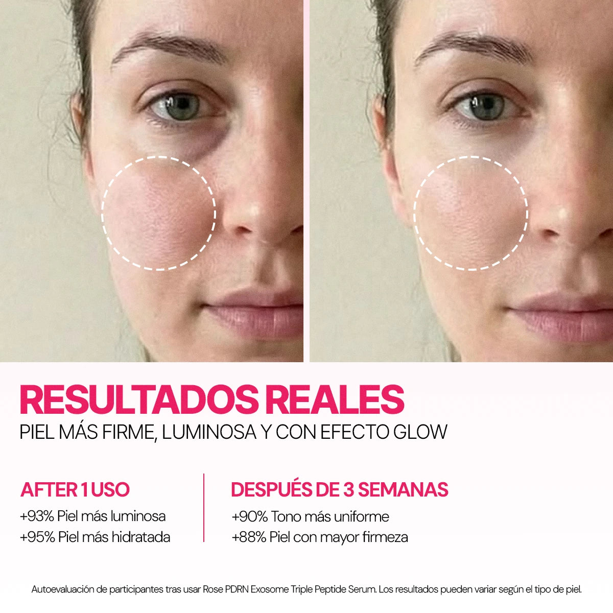 Rose PDRN Serum