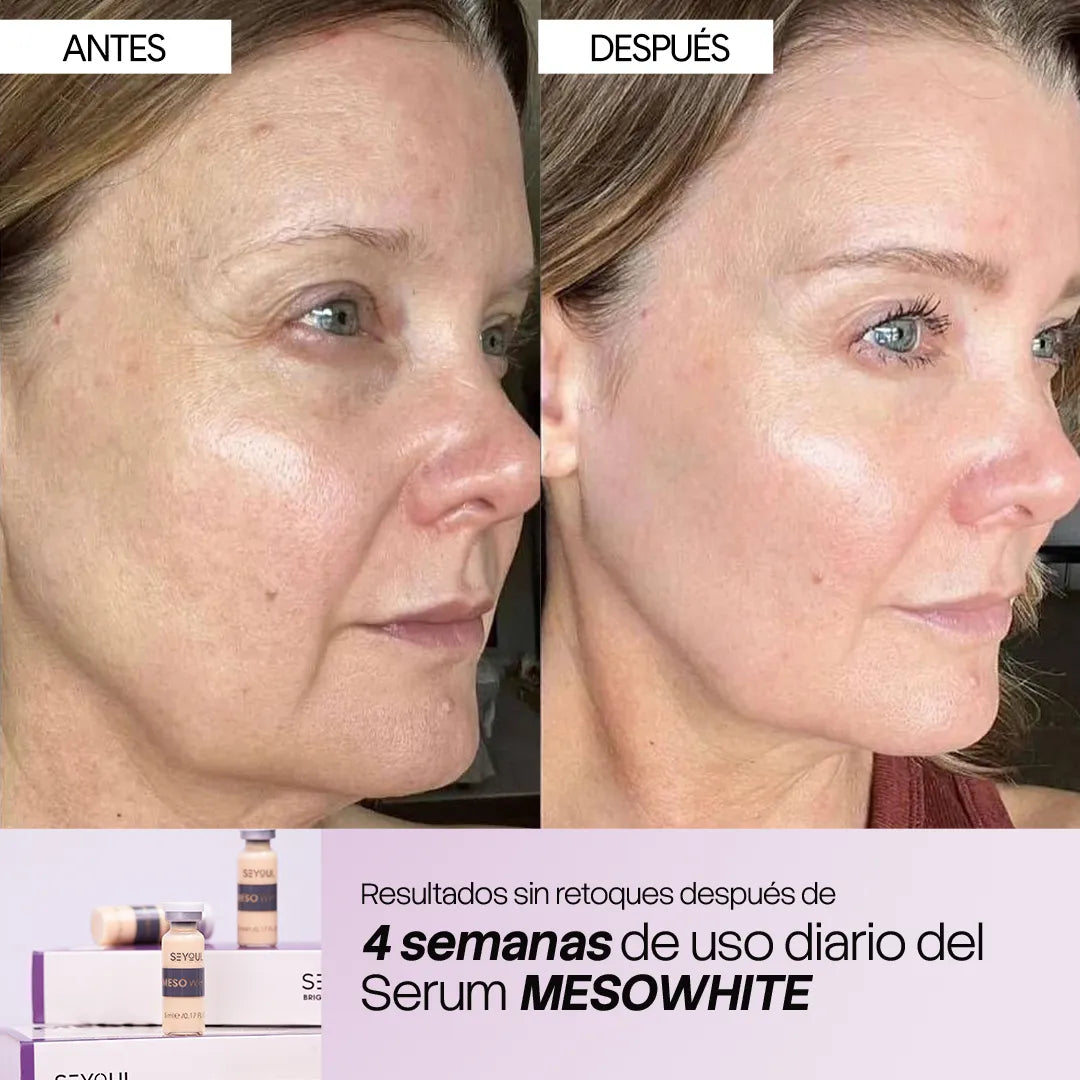 Células madre Mesowhite - Valentine