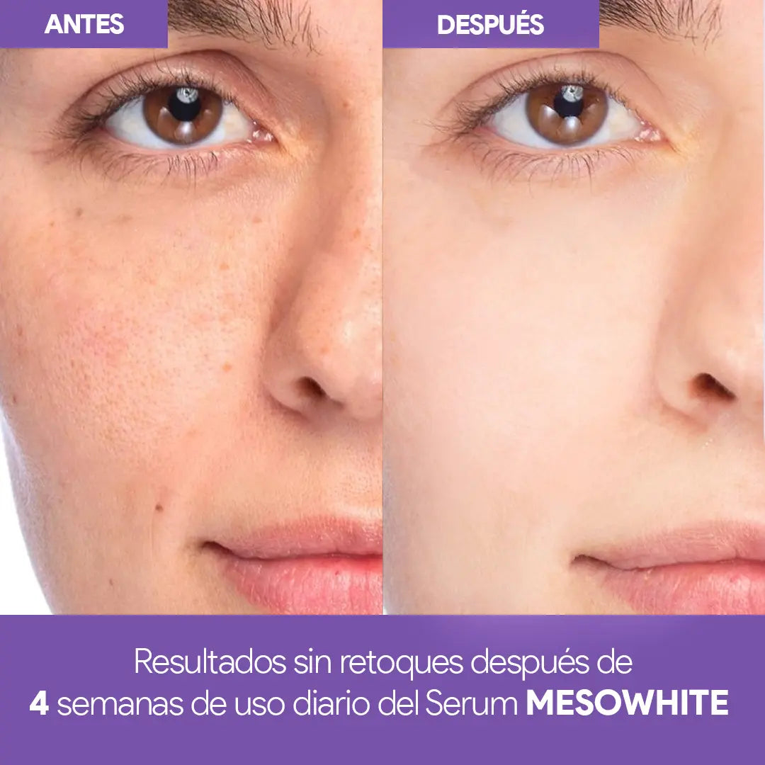 Células madre Mesowhite