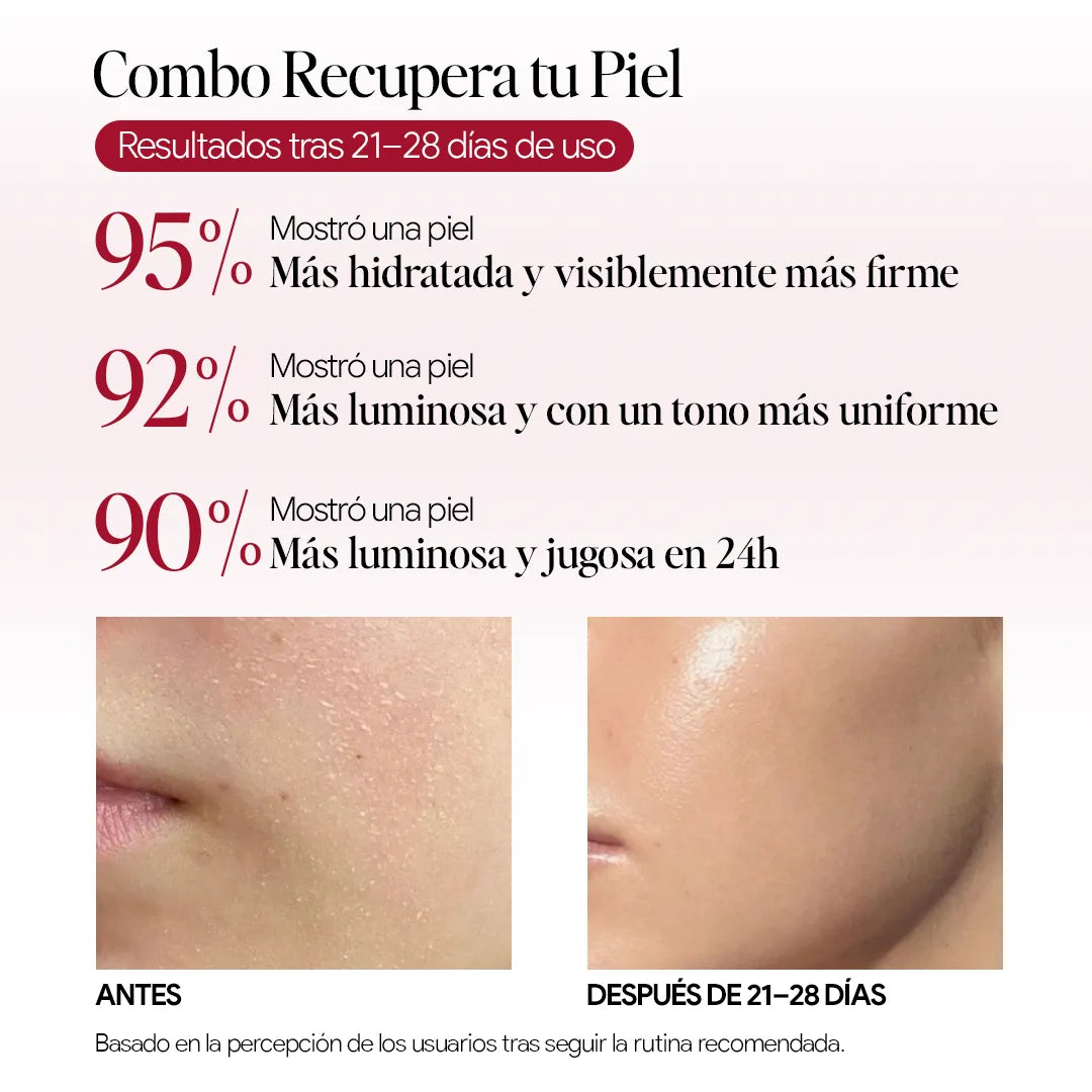 Combo Recupera tu Piel - Valentine