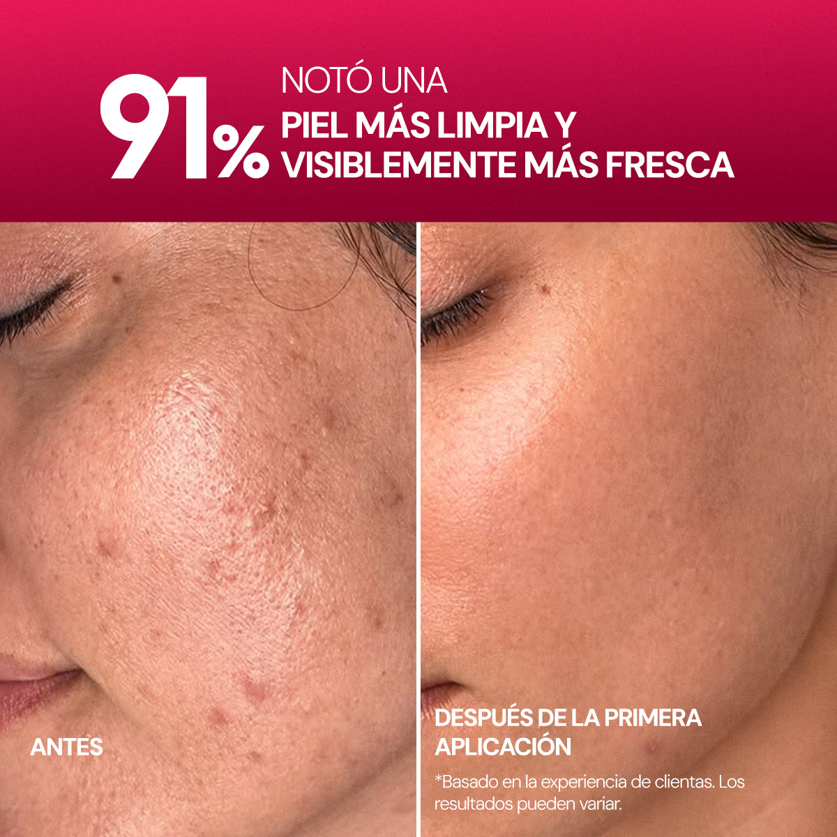Collagen Gel Essence Pads SEYOUL