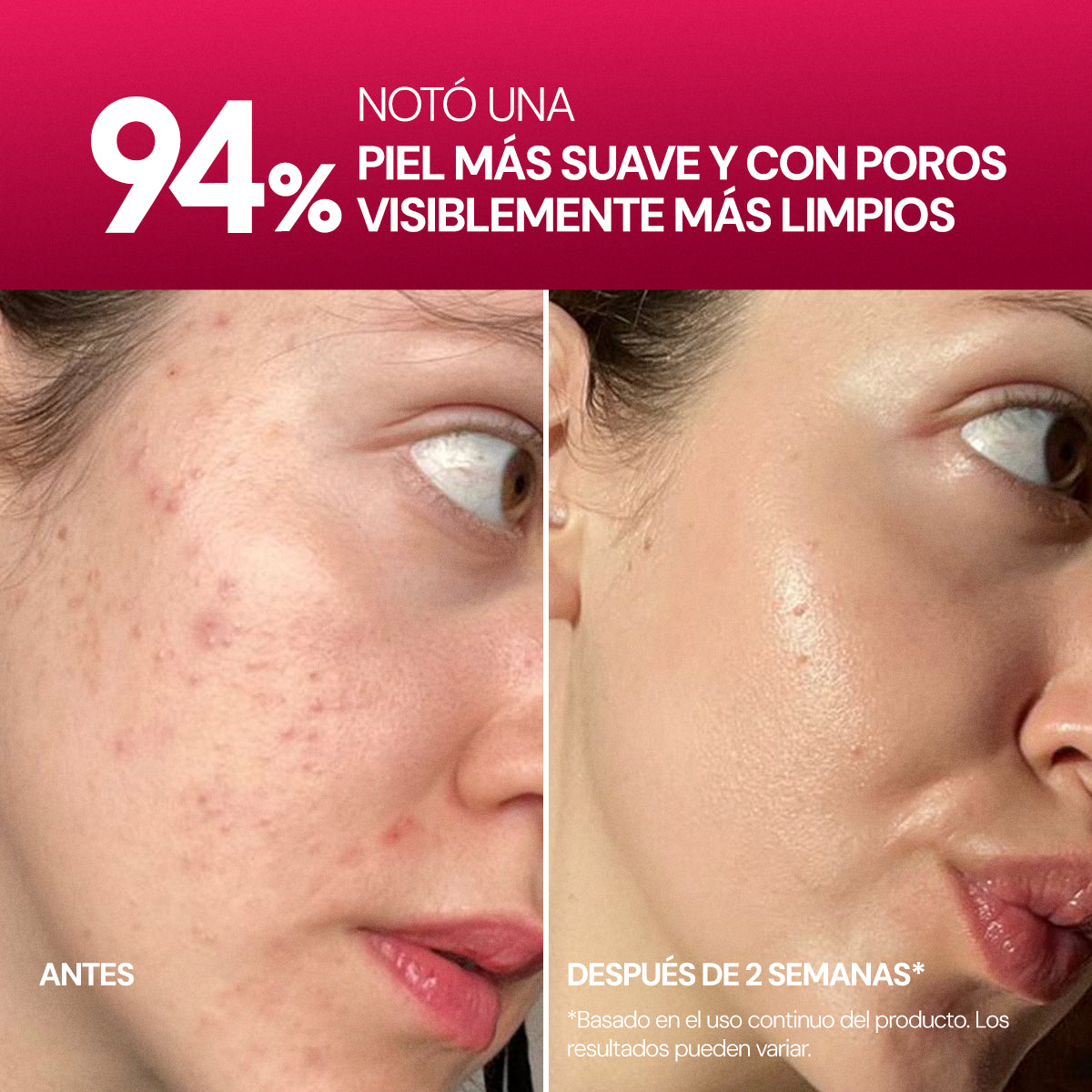 Collagen Gel Essence Pads SEYOUL