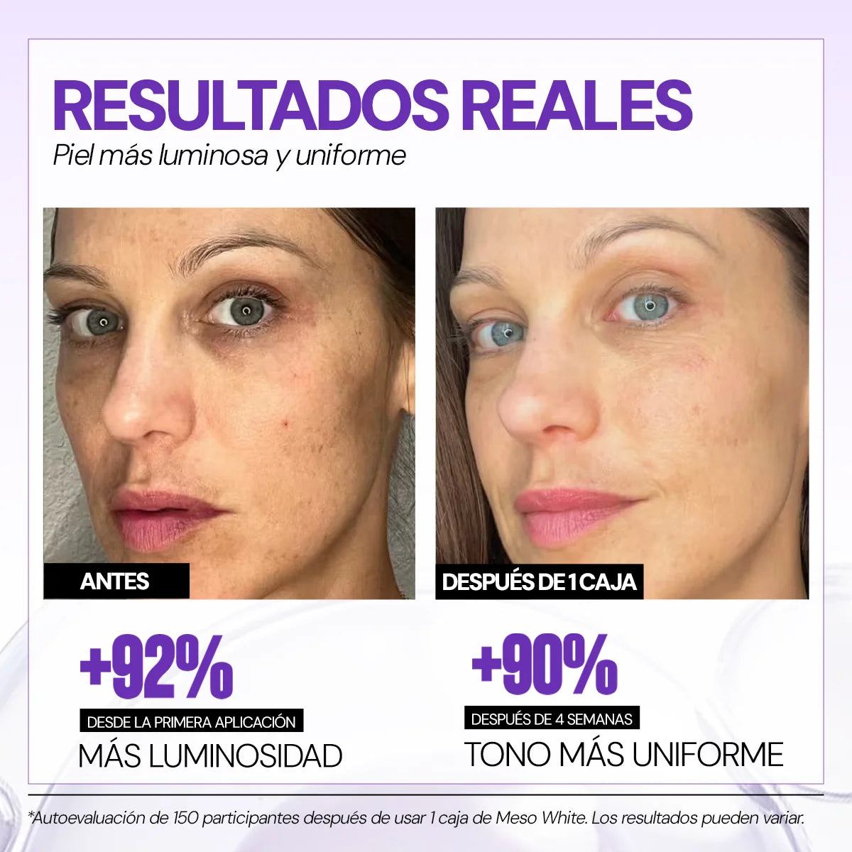 Células madre Mesowhite