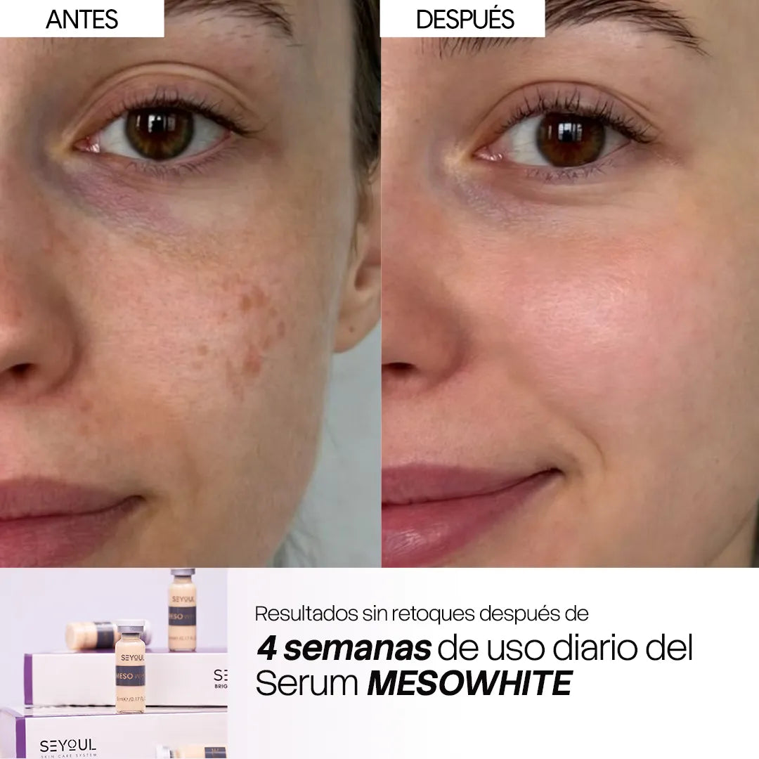 Células madre Mesowhite