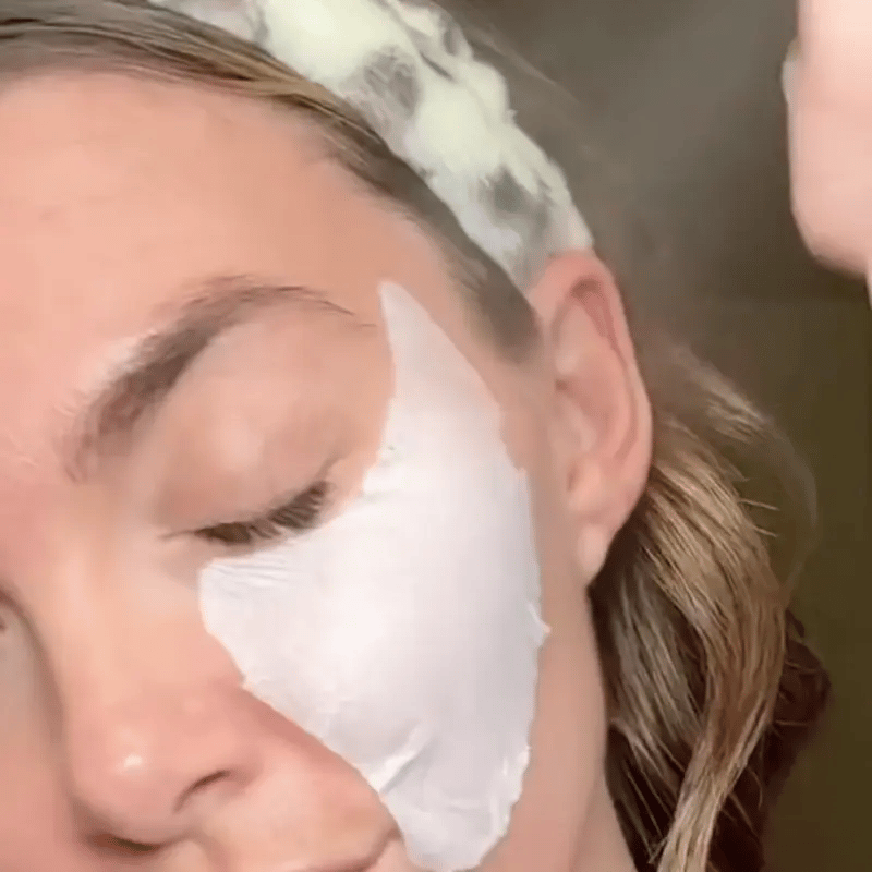 PARCHES DE COLAGENO HIDROLIZADO – TIENDA PERU