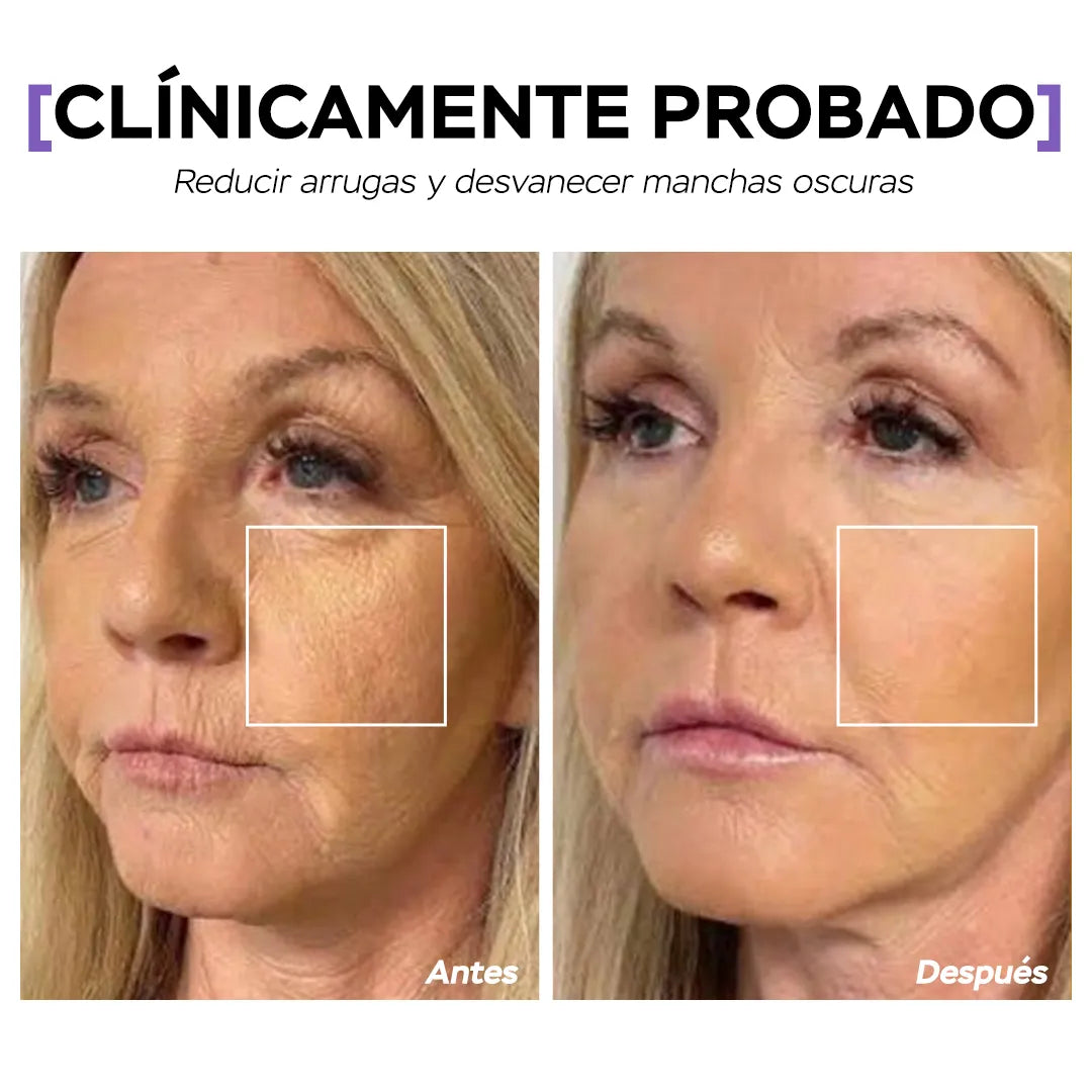 Seyoul™ Suero 21 Días - P2