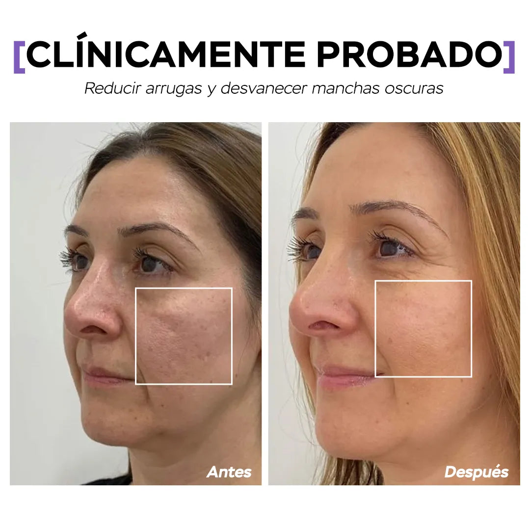 Seyoul™ Suero 21 Días - P2
