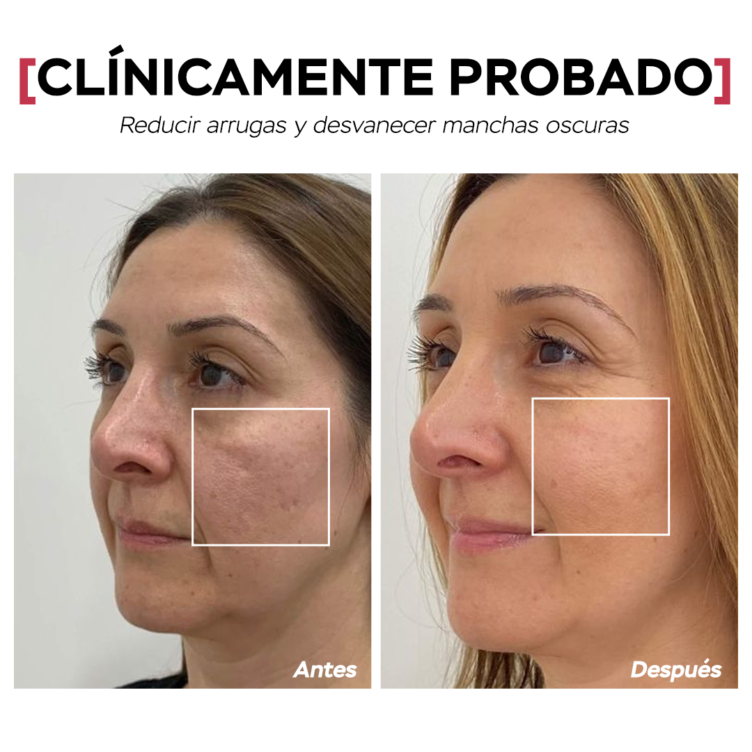 Seyoul™ Suero 21 Días - K01