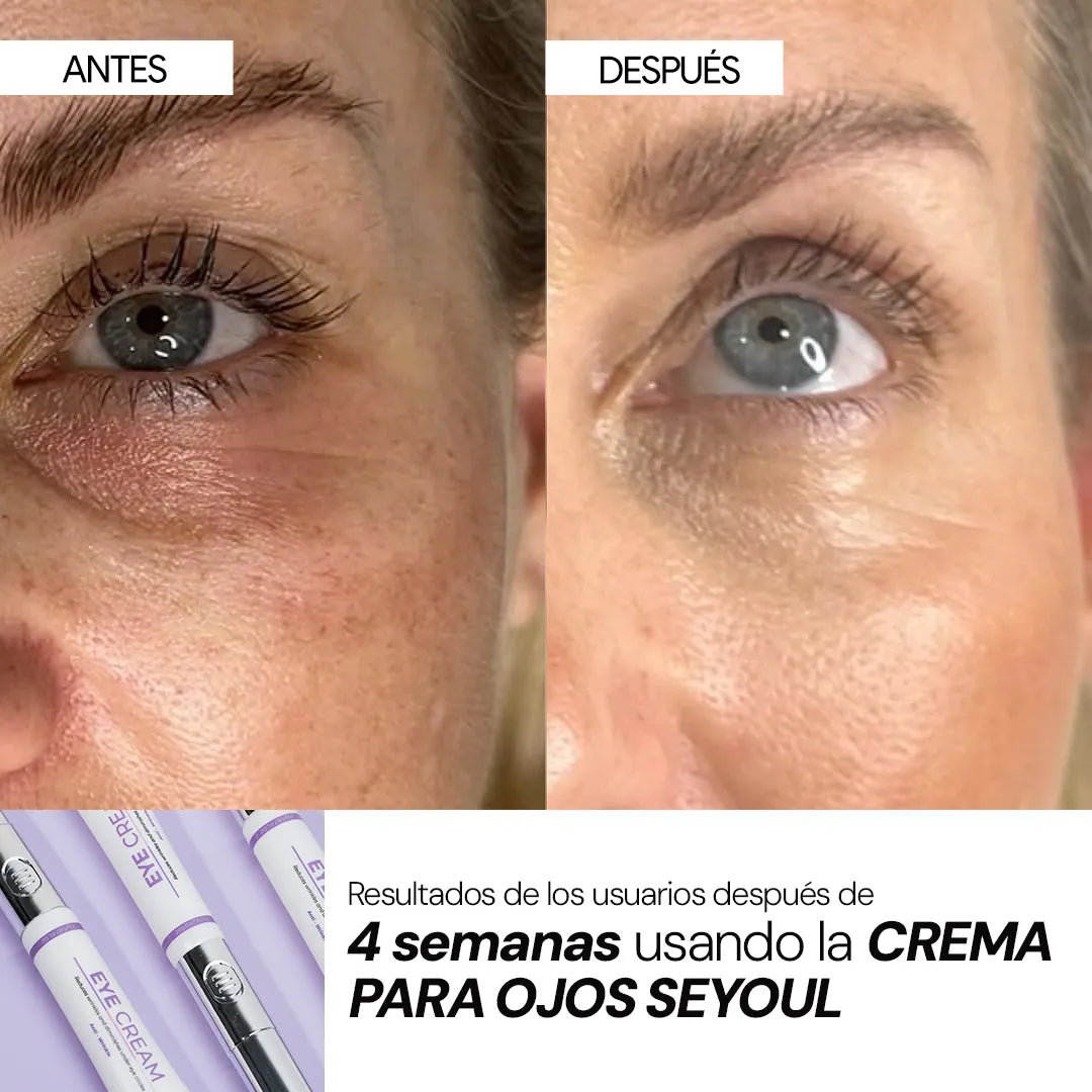 Crema Para Ojos