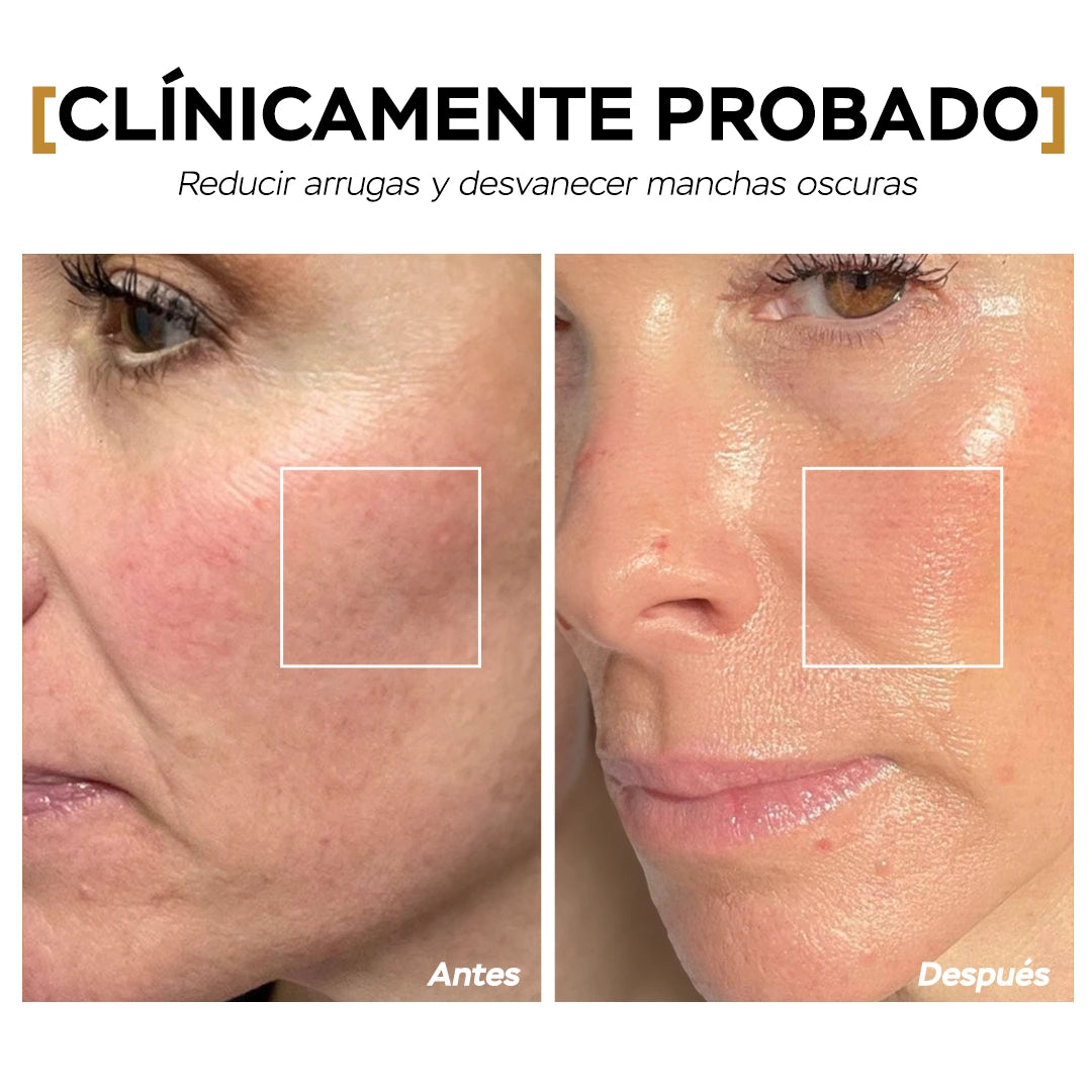 DoC Retinol (1% Retinol)
