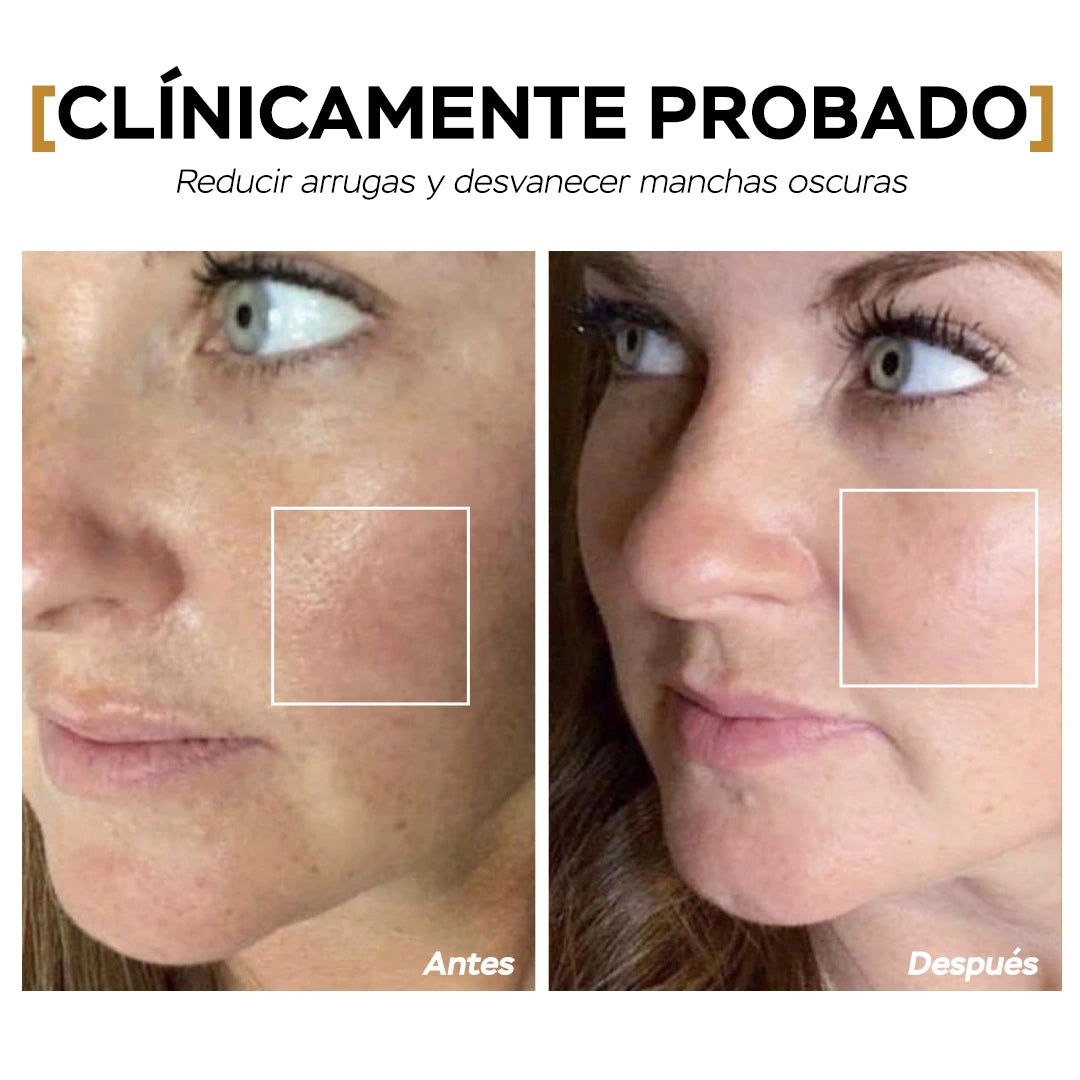 DoC Retinol (1% Retinol)