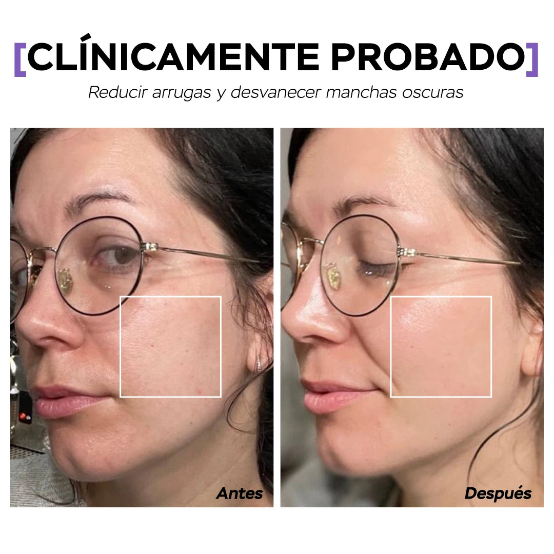 Seyoul Mascarilla de Gelatina™
