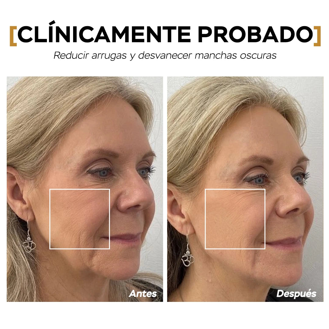 DoC Retinol (1% Retinol)