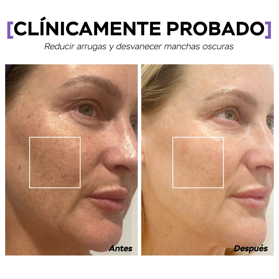 Seyoul Mascarilla de Gelatina™