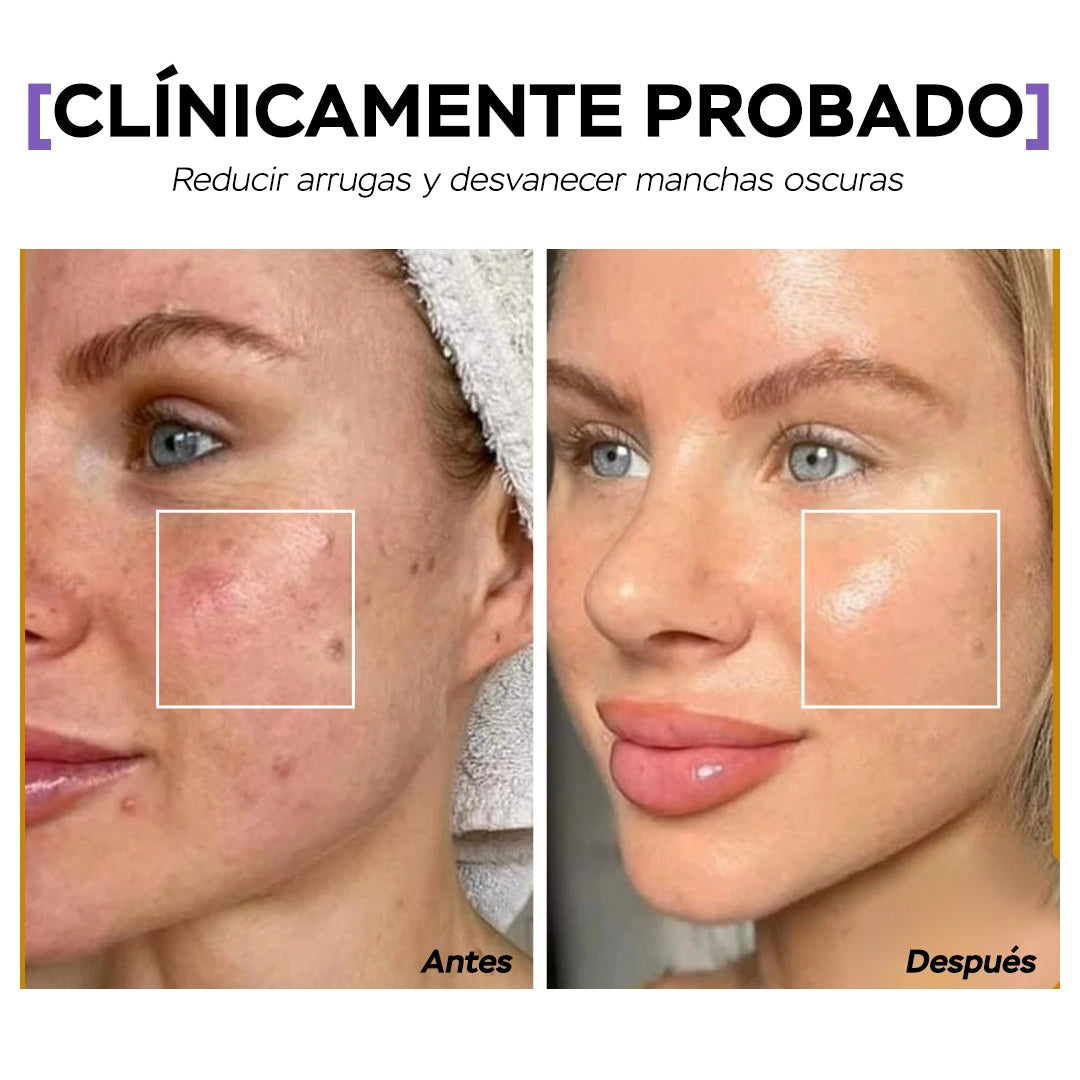Seyoul Mascarilla de Gelatina™