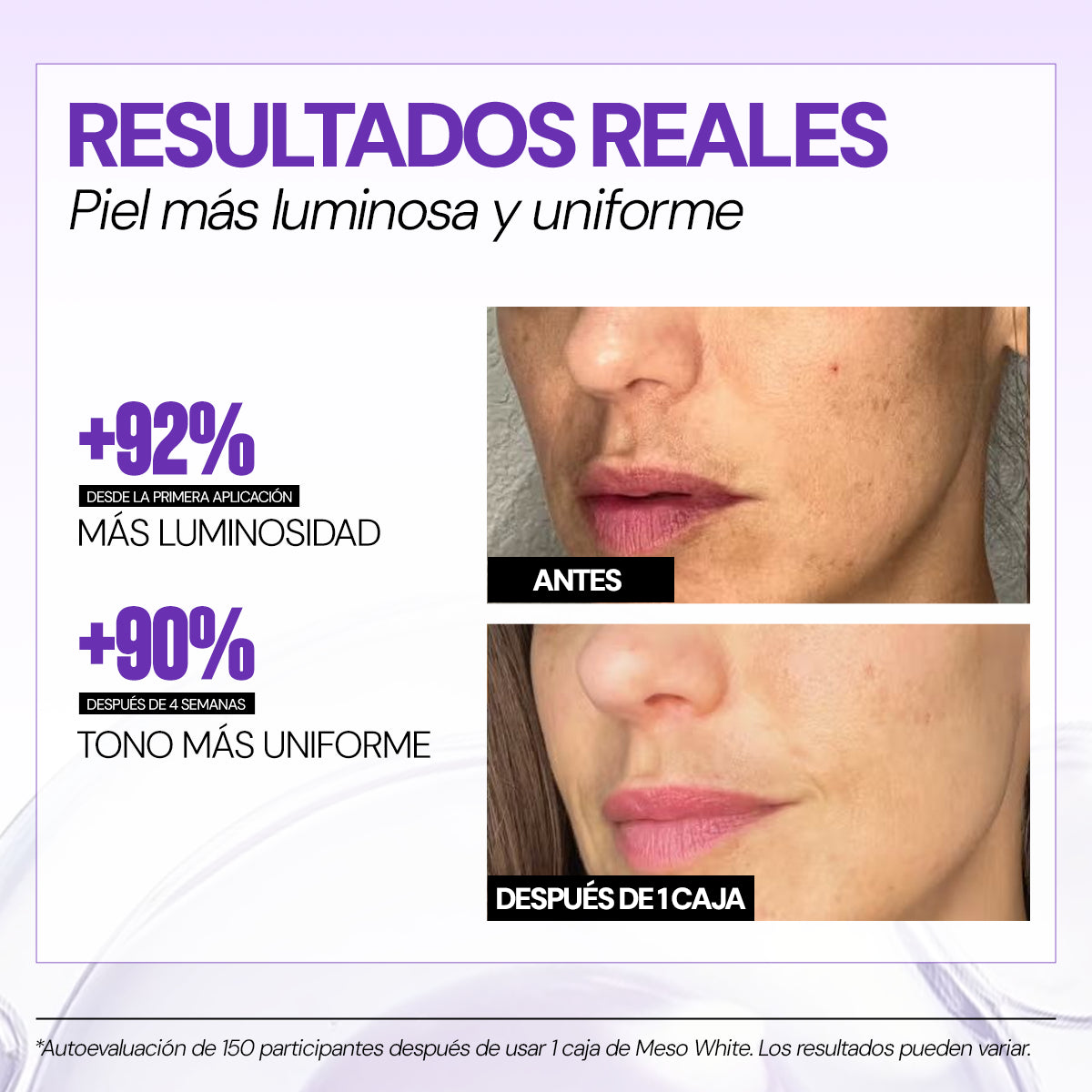 Células madre Mesowhite