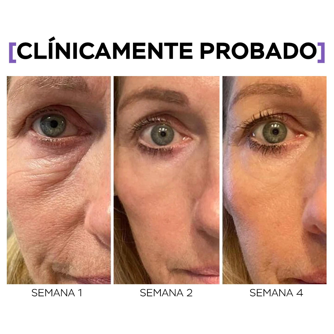 Crema Para Ojos - T01