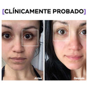 Crema Para Ojos - T01