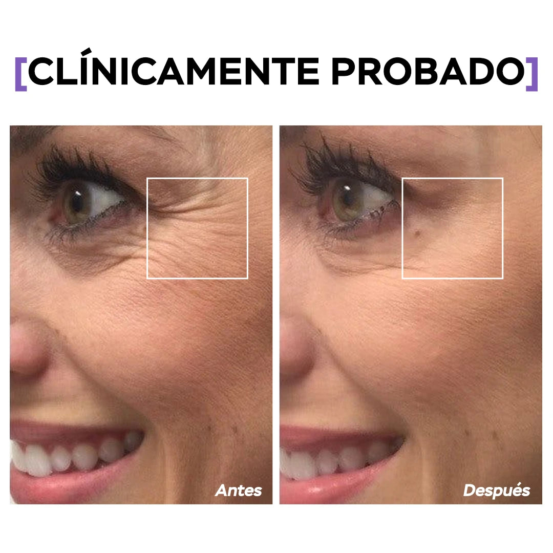 Crema Para Ojos - T01