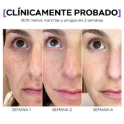 Células madre Mesowhite - K01