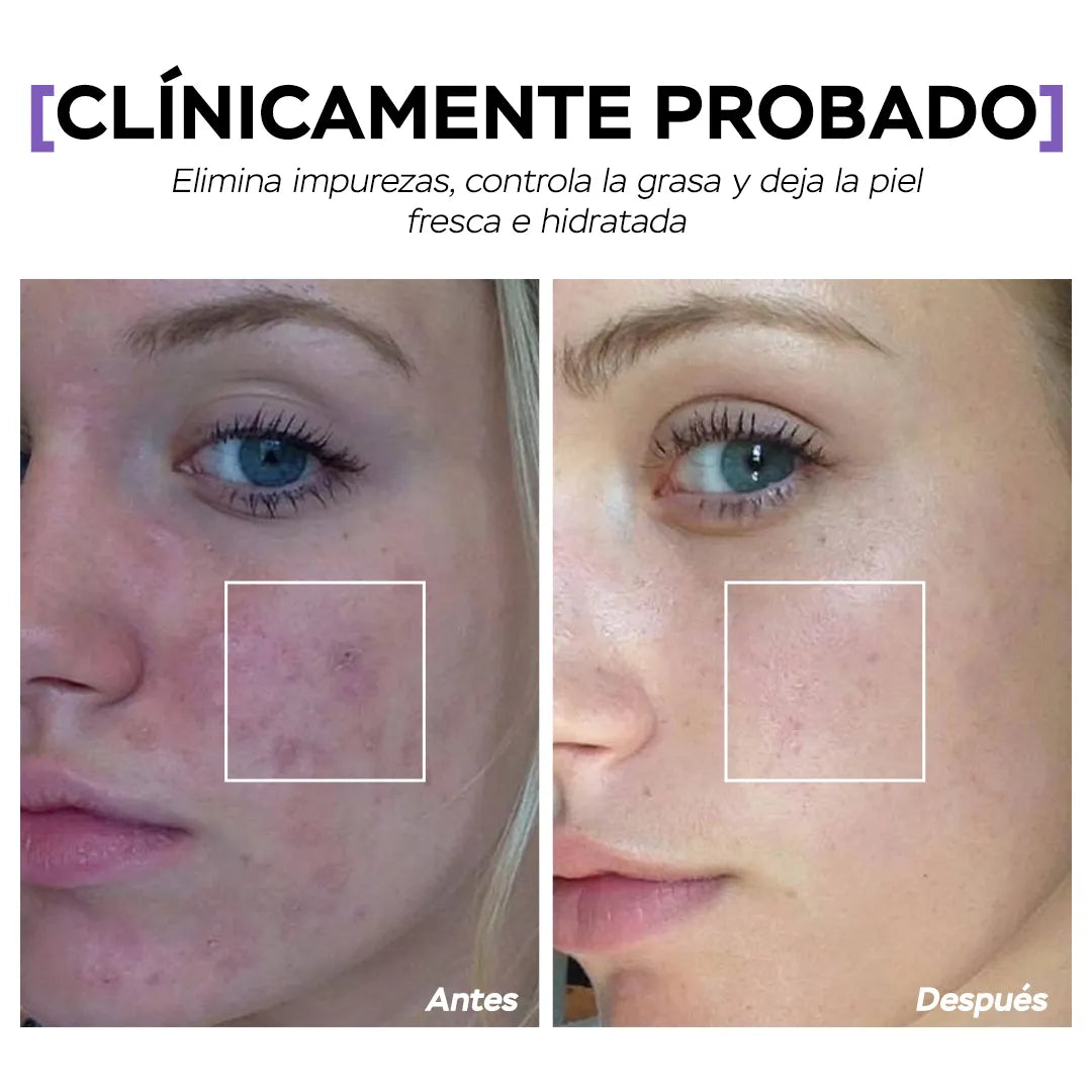 Seyoul™  Aceite Limpiador