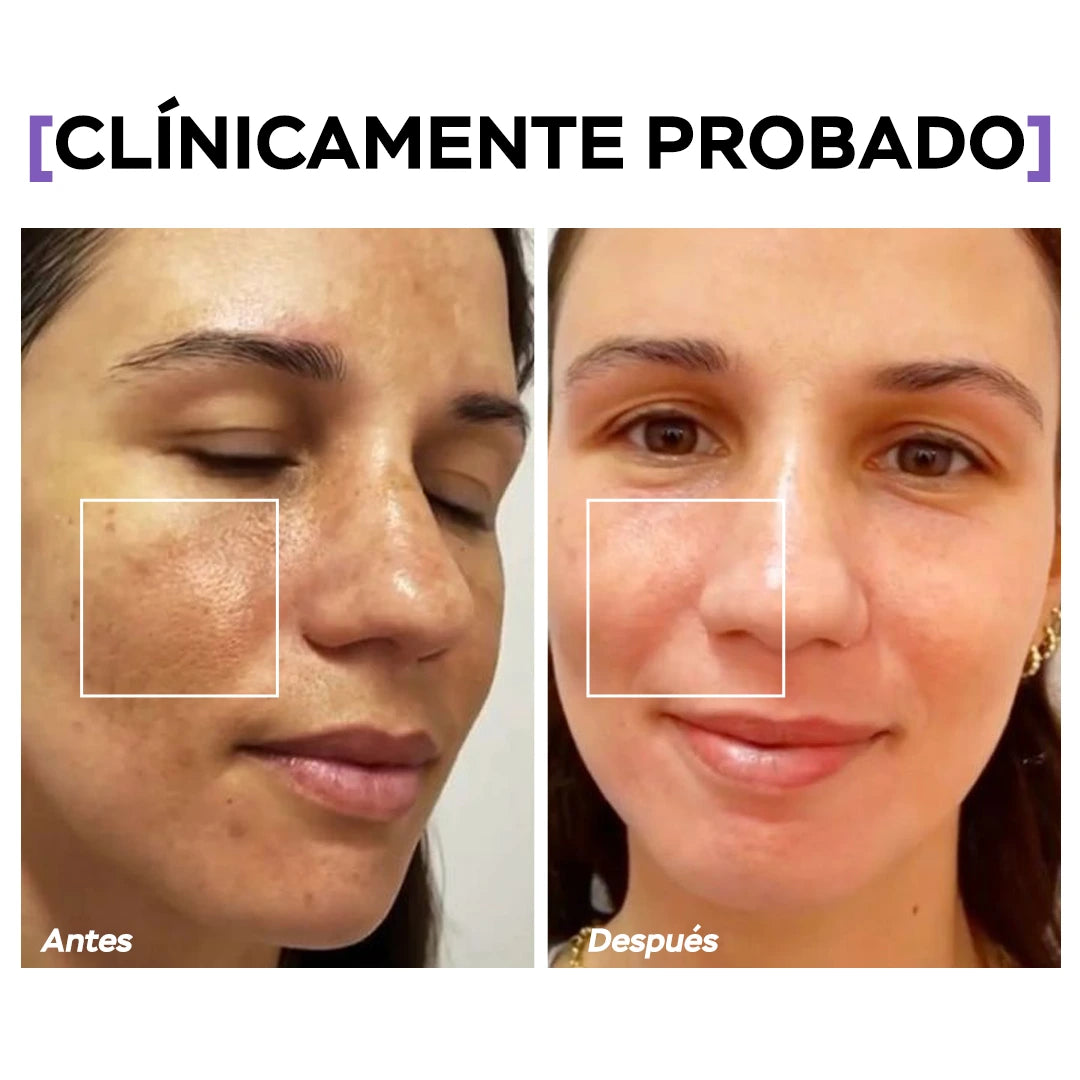 Seyoul™ Células madre Mesowhite