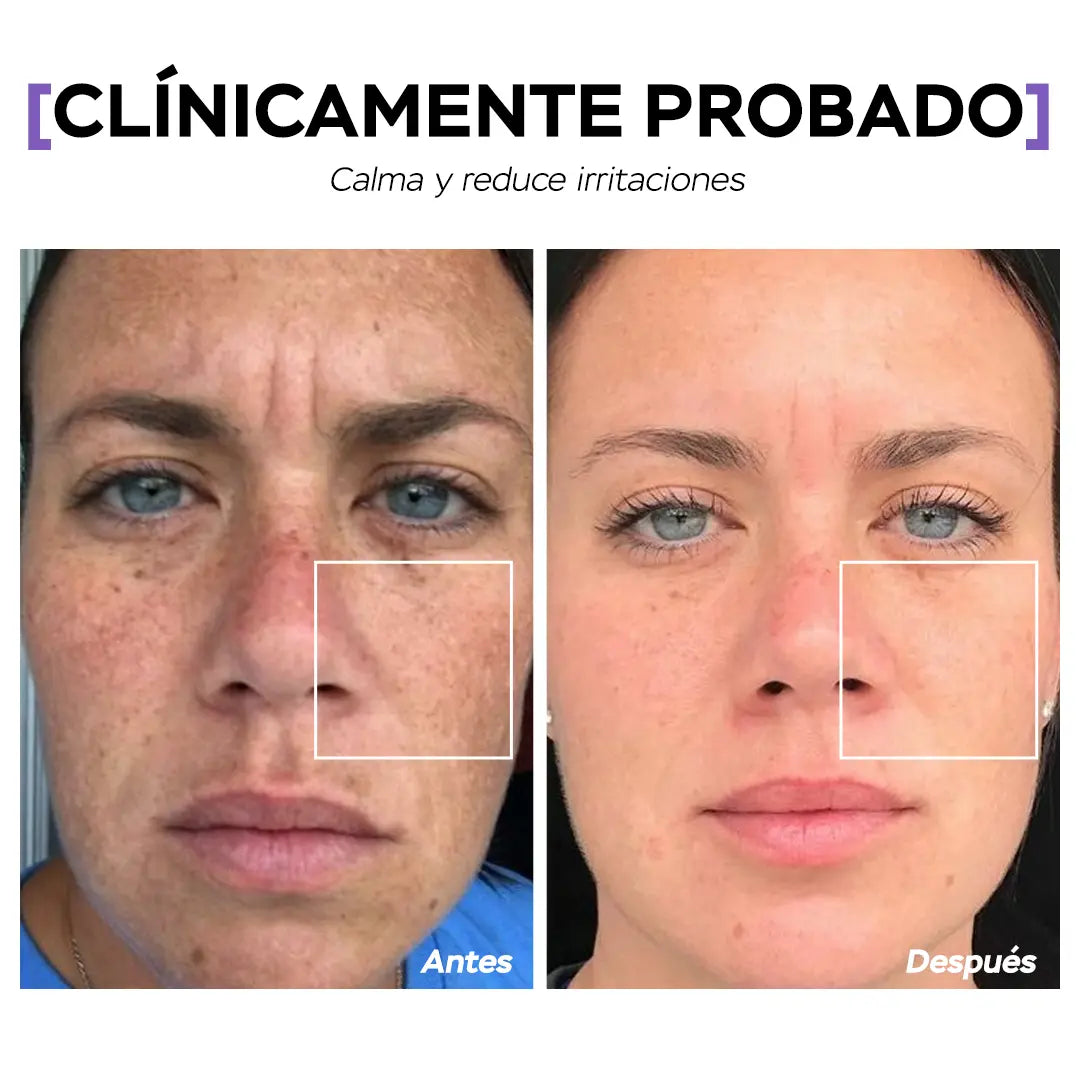 Seyoul™ Leche hidratante de regeneración SOS