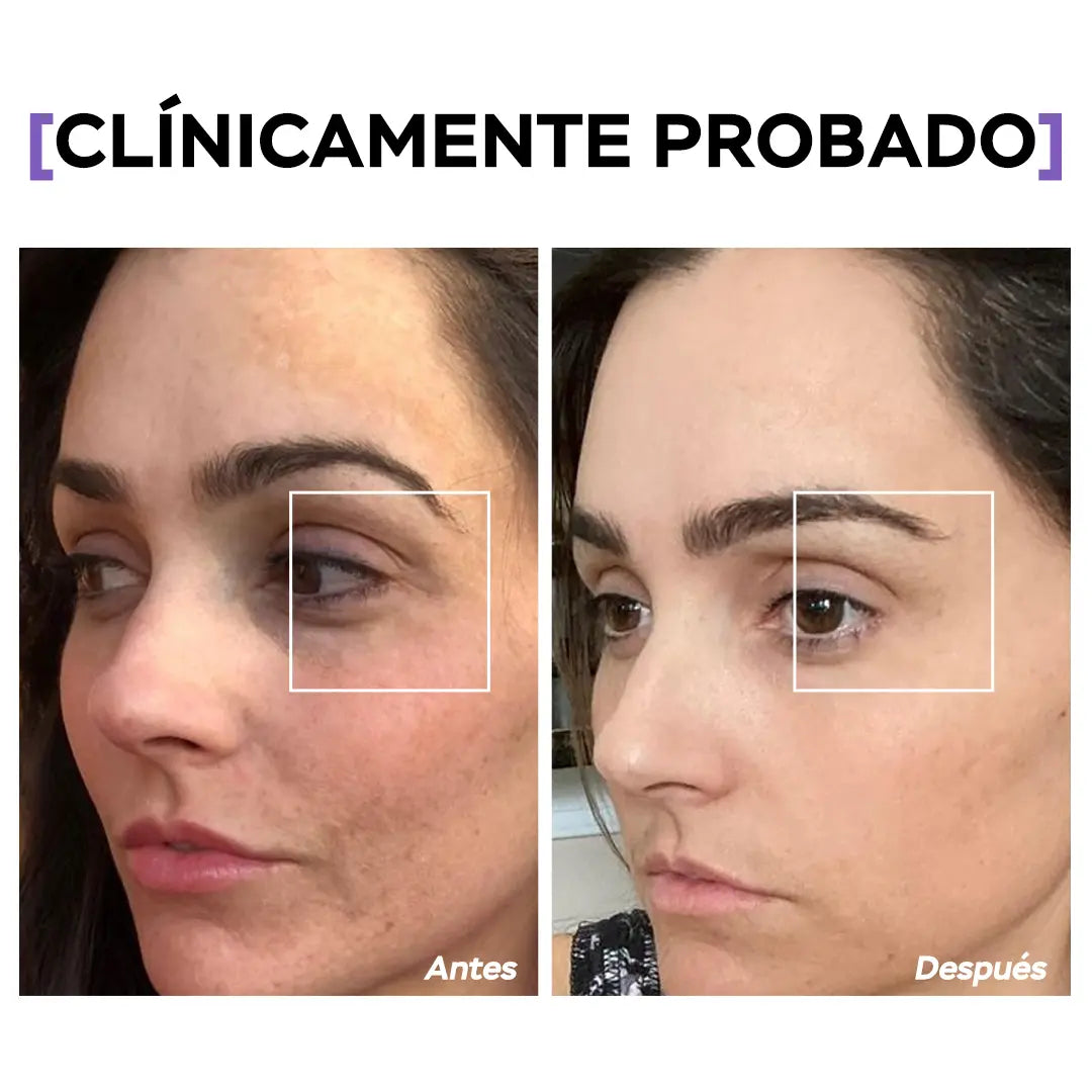 Crema Para Ojos - T01