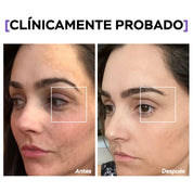 Crema Para Ojos - T01