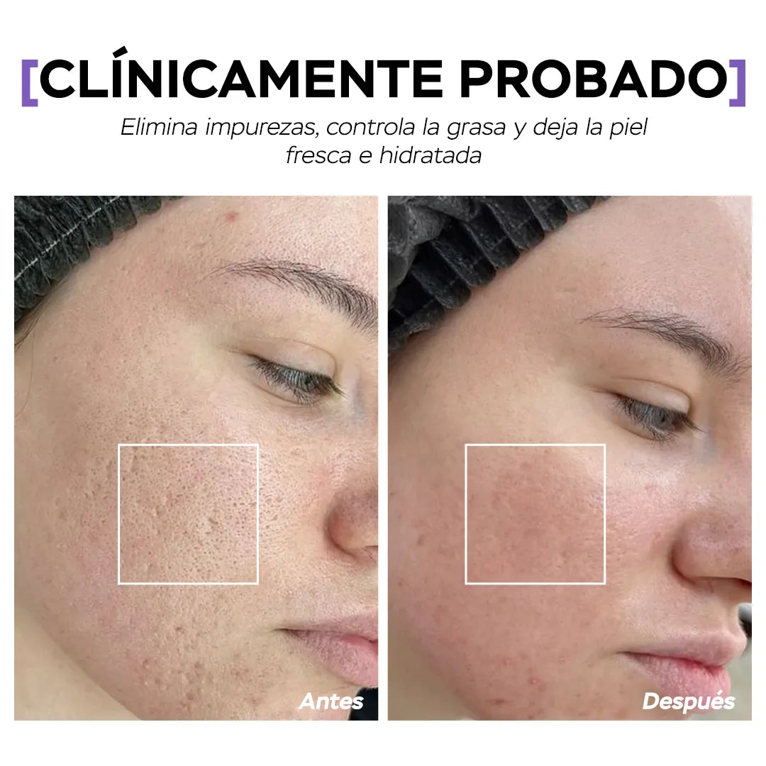 Seyoul™  Aceite Limpiador