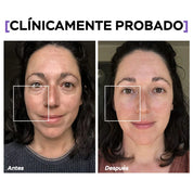 Células madre Mesowhite - K01