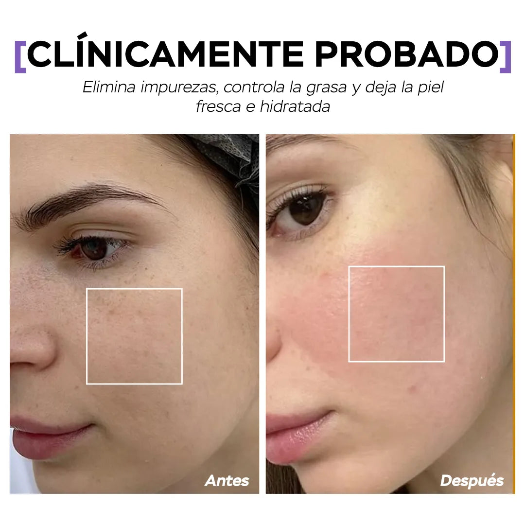 Seyoul™  Aceite Limpiador