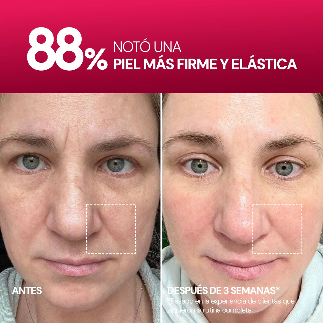 Rose PDRN Serum SEYOUL