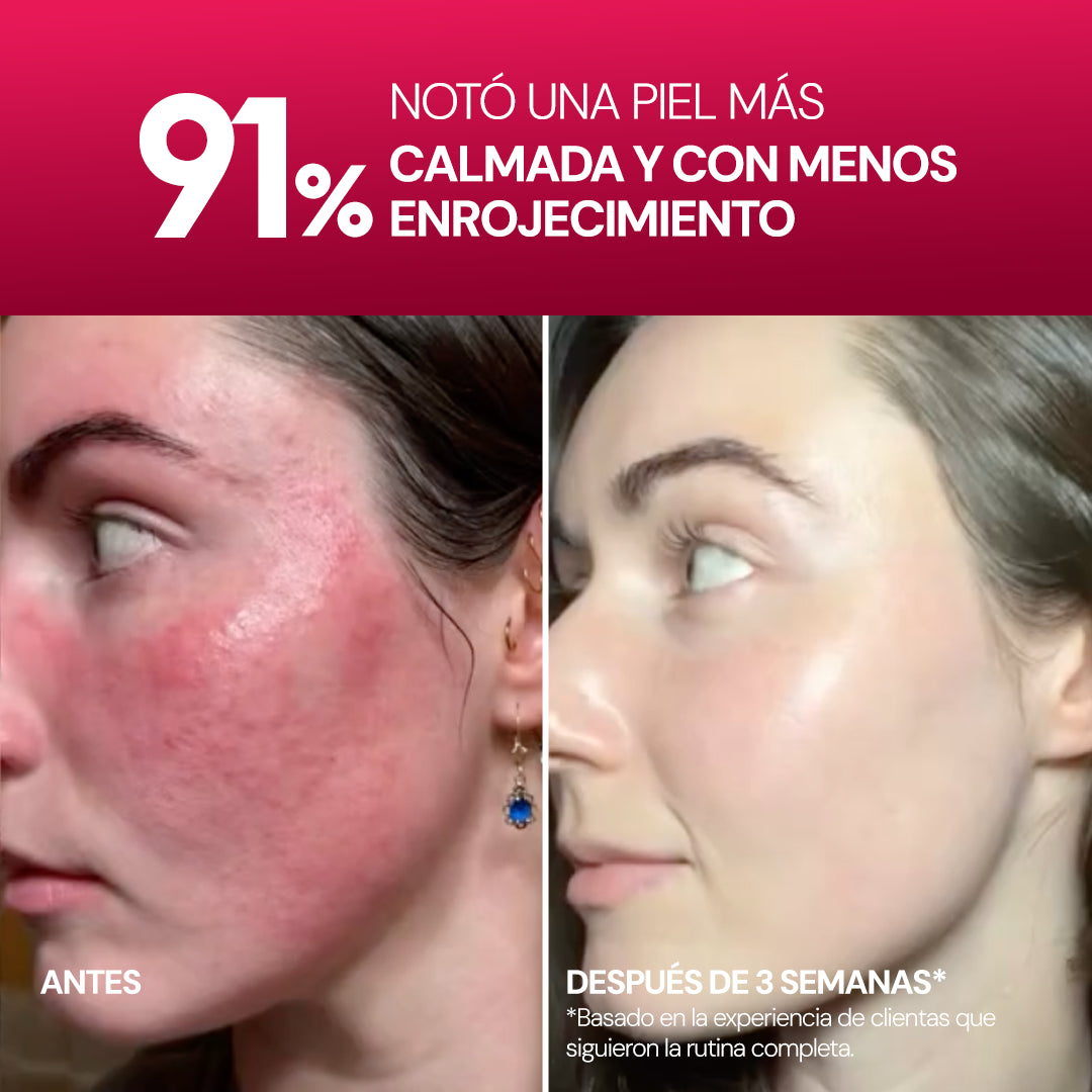 Rose PDRN Serum SEYOUL
