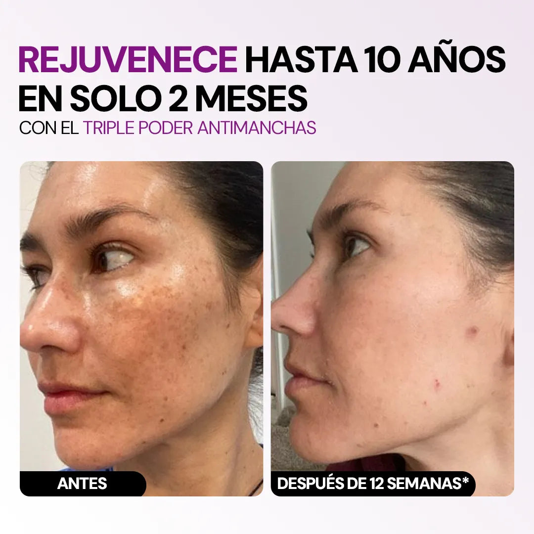 Combo Rejuvenecedor 3 en 1